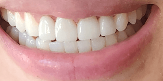 Intraoral & Extraoral Dental Photos